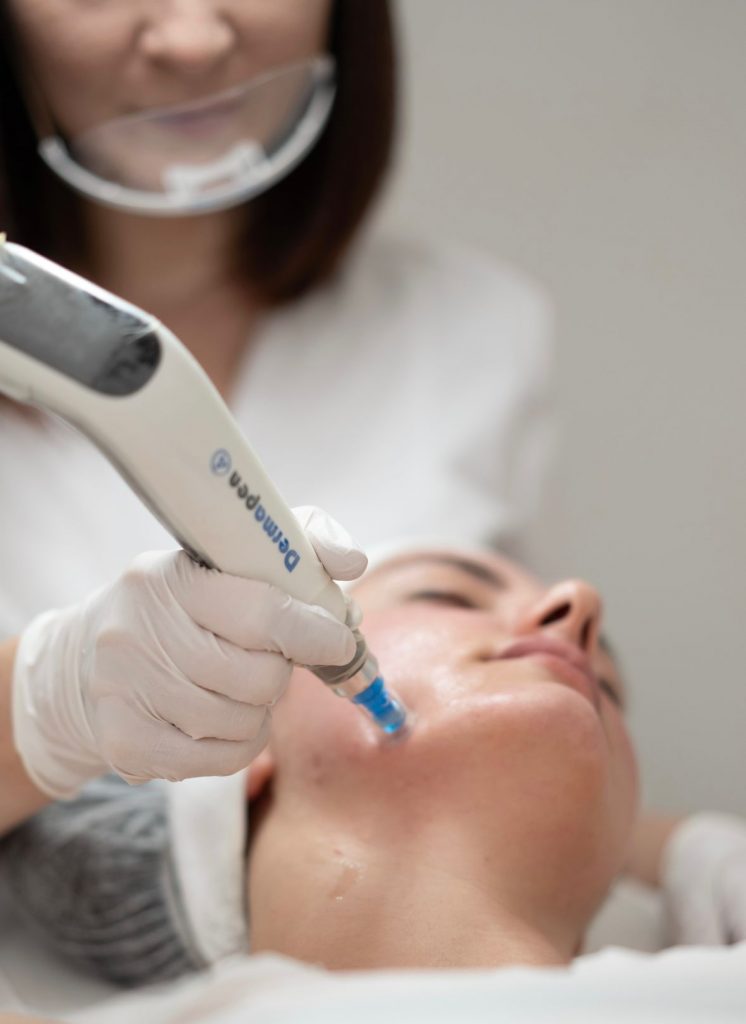 Microneedling by Ramona Ristea in Cambridge