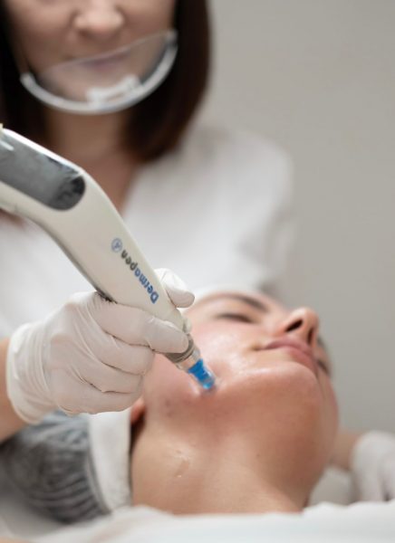 Microneedling by Ramona Ristea in Cambridge